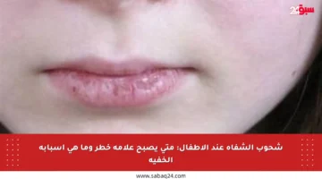 شحوب الشفاه عند الأطفال: متى يصبح علامة خطر وما هي أسبابه الخفية